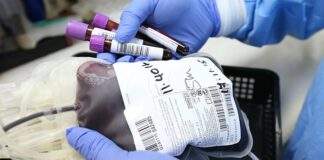 Covid-19: entra nel vivo la sperimentazione della immunoterapia con plasma in Puglia